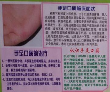 手足口病的临床表现 手足口病 手足口病-简介，手足口病-临床表现