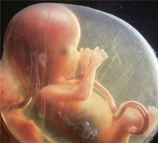 怎样确定胎儿停止发育 胎儿停止发育的症状