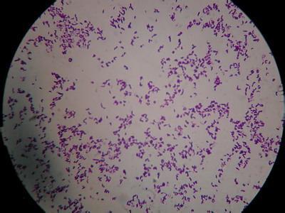 谷氨酸棒状杆菌发酵 谷氨酸棒状杆菌