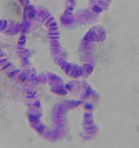 果蝇的唾液腺染色体 果蝇唾腺染色体