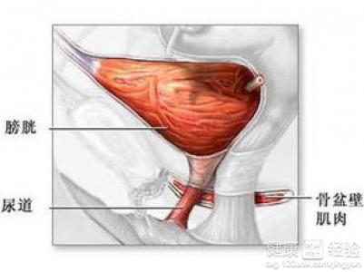 腺性膀胱炎症状 腺性膀胱炎 腺性膀胱炎-腺性膀胱炎的症状是什么?，腺性膀胱炎-腺