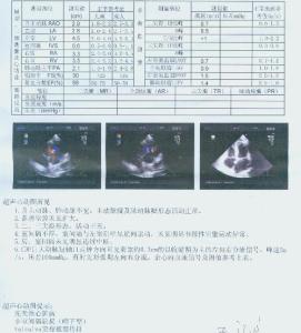 天生单肾注意事项 先天性单肾 先天性单肾-简介，先天性单肾-注意事项