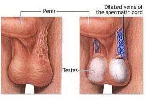 阴囊潮湿下垂 阴囊下垂 阴囊下垂-功用，阴囊下垂-备注