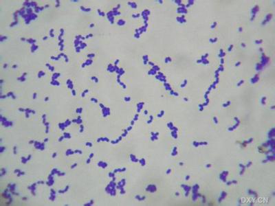 粪肠球菌的培养温度 粪肠球菌 粪肠球菌-体型特征，粪肠球菌-培养