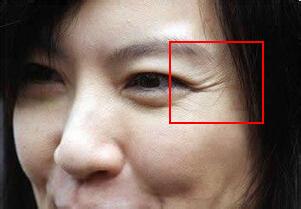 纹完眼线怎样消肿 怎样消眼纹 如何消眼纹