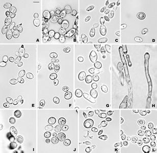 白色假丝酵母 白色假丝酵母菌 白色假丝酵母菌-概述，白色假丝酵母菌-生物学性