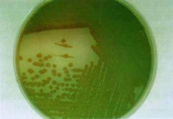铜绿假单胞菌感染 铜绿假单胞菌感染 铜绿假单胞菌感染-病原，铜绿假单胞菌感染-流