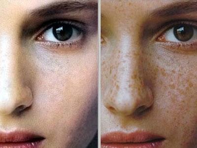 女生脸上长斑的原因 脸上长斑的原因