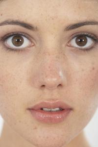 20女生脸上长斑的原因 女生脸上长斑的原因