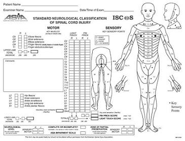 脊髓损伤 脊髓损伤 脊髓损伤-简介，脊髓损伤-概述