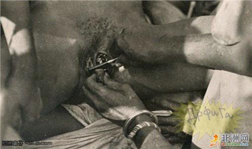 男性割礼的好处 割礼 割礼-由来，割礼-男性割礼