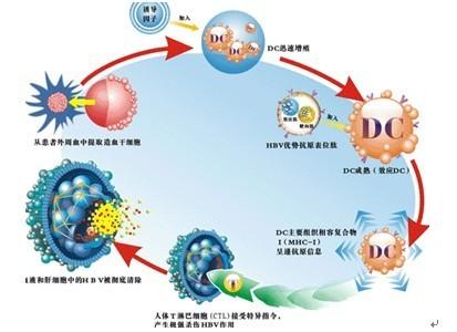 dc cik细胞免疫治疗 DCCIK细胞免疫技术 DCCIK细胞免疫技术-什么是DC-CIK细胞免疫技术