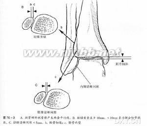 急性前列腺炎病因病理 踝部骨折 踝部骨折-疾病概述，踝部骨折-病理病因