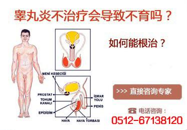 睾丸炎的病因 睾丸炎 睾丸炎-症状体征，睾丸炎-病理病因