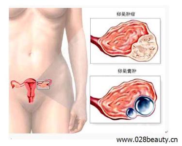 保养卵巢的最好方法 卵巢保养的方法，推荐7个保养卵巢的有效方法