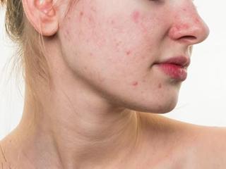 皮肤过敏治疗偏方 皮肤过敏偏方？
