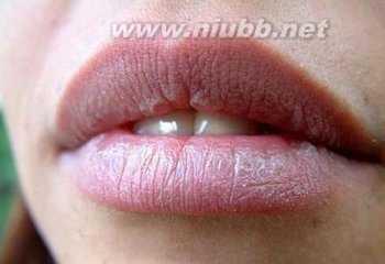 嘴唇发紫是什么原因 嘴唇发紫 嘴唇颜色反应身体疾病