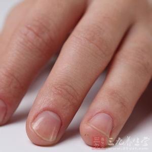 手指甲上有竖纹 指甲上有竖纹是怎么回事 三大因素最关键（11）