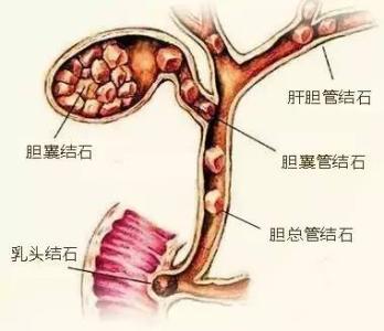 缺钾吃什么补的最快 人体缺钾有什么症状