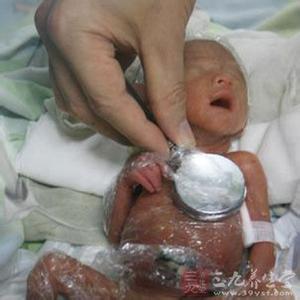 早产儿回家怎么样护理 早产儿的护理 早产儿应该怎么护理