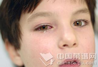 老人患肺炎的治疗 红眼病的治疗方法 老人患了红眼病应该这样做