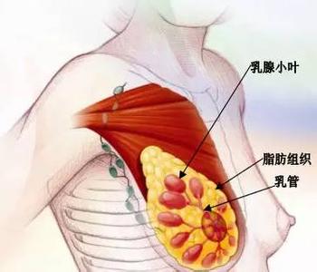 乳腺增生的早期症状 乳腺增生的早期症状 五原因导致乳腺增生