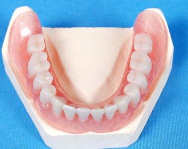 活动假牙保养 活动假牙 活动假牙-介绍，活动假牙-活动假牙的使用和保养