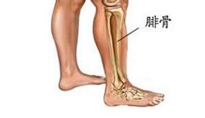 胫腓骨的概述 胫腓骨骨折 胫腓骨骨折-疾病概述，胫腓骨骨折-病理原因