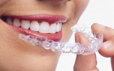 牙齿矫正步骤 牙齿矫正的具体步骤都有哪些