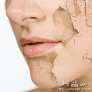 皮肤干燥怎么保湿 皮肤干燥怎么办 皮肤有效保湿的方法