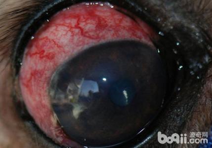 青光眼的早期症状表现 青光眼的早期症状 6个表现提示眼睛问题