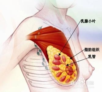 乳腺小叶增生的原因 乳腺增生的原因 应警惕五因素