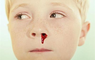 流鼻血是什么病的前兆 流鼻血是什么原因