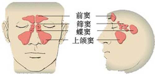 鼻窦炎的危害 鼻窦炎的危害 鼻窦炎的六大危害是什么