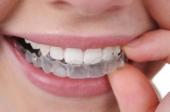 牙齿矫正的危害 牙齿矫正的最佳年龄