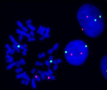 fish荧光原位杂交 荧光原位杂交 荧光原位杂交-荧光原位杂交（FISH）技术详解，荧光