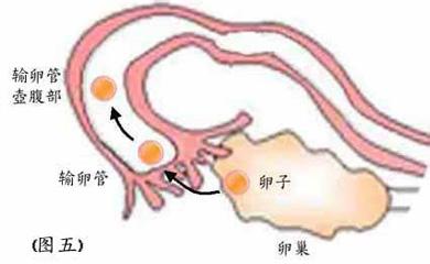 病理学的概述 输卵管炎 输卵管炎-概述，输卵管炎-病理