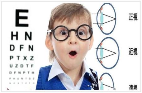 治疗近视眼最好的方法 近视眼怎么办，治疗近视的最好方法