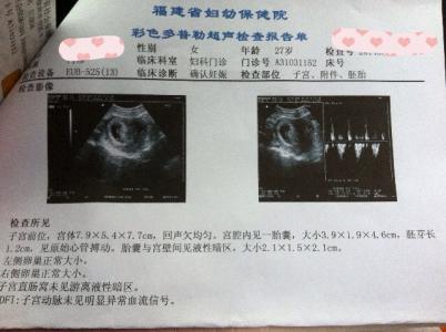 先兆流产饮食禁忌 先兆流产不能吃什么 先兆流产禁忌的食物