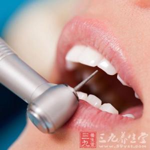 蛀牙牙痛的治疗方法 蛀牙怎么办 蛀牙的病因和治疗方法有哪些