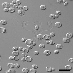 酵母菌形态 酵母菌 酵母菌-简介，酵母菌-形态