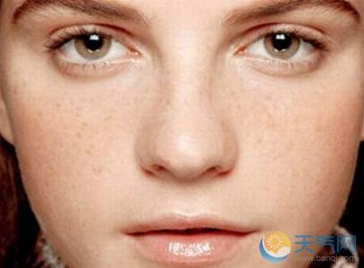 脸上斑点越来越多原因 脸上长斑怎么调理