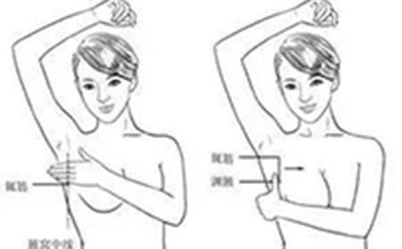 乳腺增生的治疗方法 乳腺增生的按摩方法