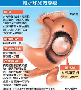 胃水球 胃水球 胃水球-胃水球，胃水球-相关条目
