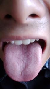 儿童舌苔厚白怎么调理 舌苔厚白是怎么回事 舌苔厚白的调理方法