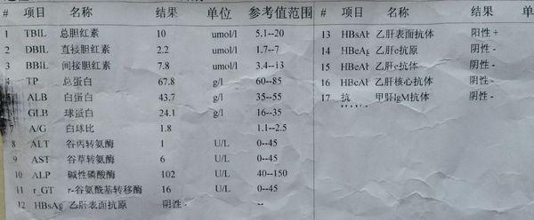 乙肝病毒携带者的症状 乙肝病毒携带者症状 乙肝有哪些表现