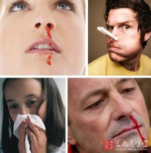 为什么会流鼻血 为什么会流鼻血 流鼻血如何饮食