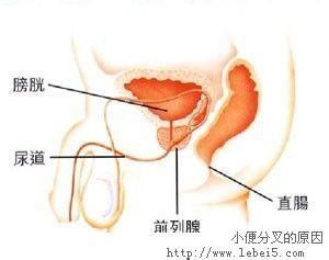 小便分叉 小便分叉 小便分叉-小便分叉概述，小便分叉-小便分叉分类