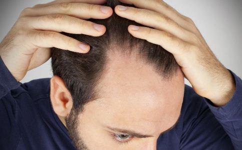 脱发怎么治 脱发有什么好的治疗方法