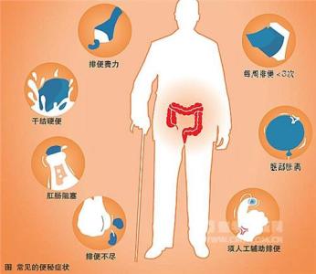 导致便秘的原因 导致老年人便秘的原因有哪些、原因分析